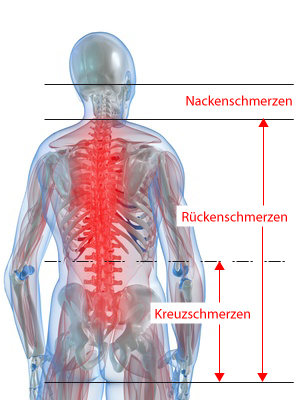 Kreuzschmerzen - Rückenschmerzen
