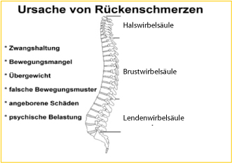 Ursachen von Rückenschmerzen und Kreuzschmerzen